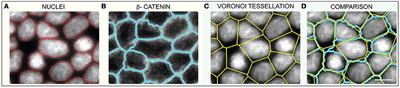 Limits of Applicability of the Voronoi Tessellation Determined by Centers of Cell Nuclei to Epithelium Morphology